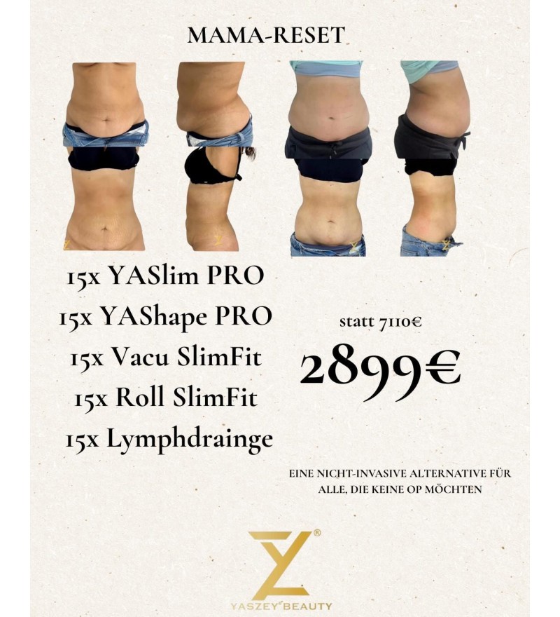 Pakket 8 - Mama Reset - (15x) YASlim Pro, YAShape Pro, Vacu SlimFit, Roll SlimFit, Lymfedrainage